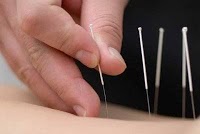 West Malling Acupuncture 726331 Image 0